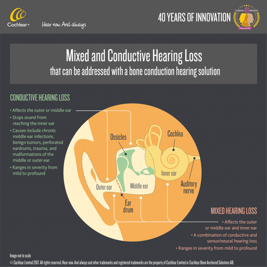 searching-for-a-treatment-for-mixed-hearing-loss