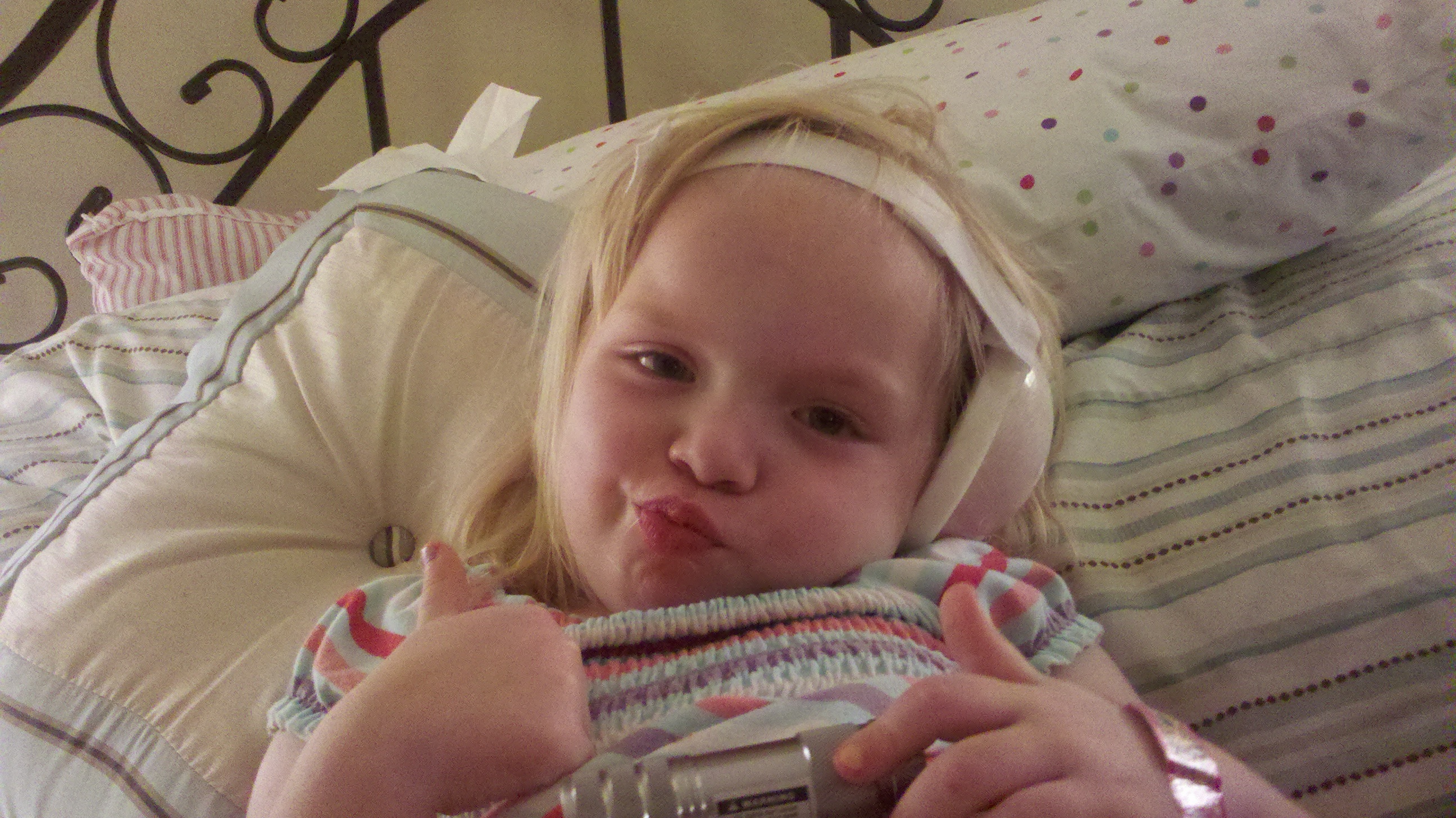 Katie after cochlear implant surgery, from meningitis and hearing loss