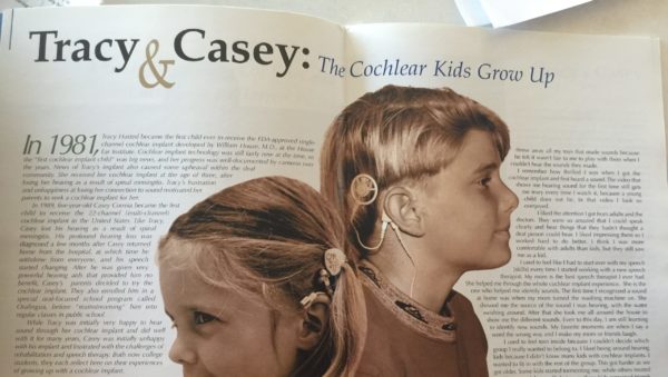 Casey made cochlear implant history as one of the first children in North America to be implanted. 