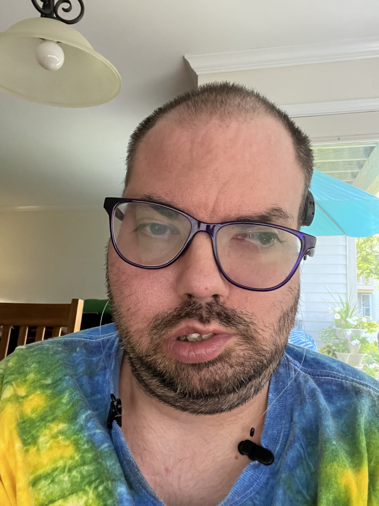 Chad Struggled With Bilateral Conductive Hearing Loss Until The Osia System