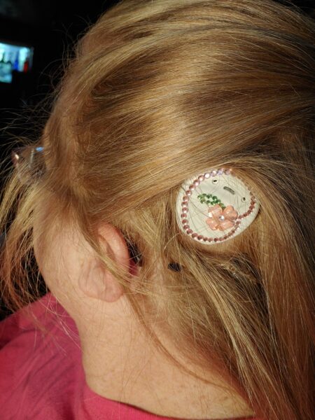 Lisa, whose cochlear implant was a solution for her single-sided deafness, with her Kanso Sound Processor decorated. 