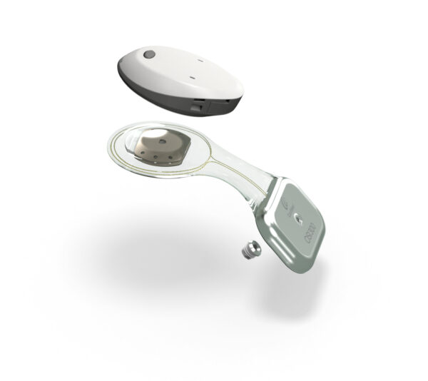 A photo of the Cochlear™ Osia® System paired with the Osia Sound Processor. 