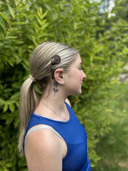 Samantha, who regained her confidence from severe hearing loss from Cystic fibrosis with her cochlear implants, showing her sound processor and her new rose tattoo which marks the location of her implant. 