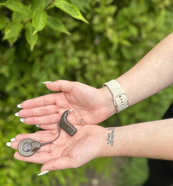 Samantha, who regained her confidence from severe hearing loss from Cystic fibrosis with her cochlear implants, holding her sound processor in her hands. 