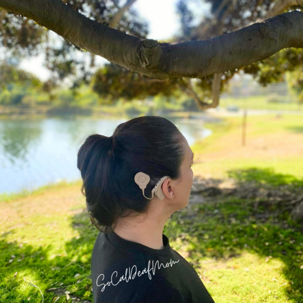 Sandra, who overcame her hearing loss with a cochlear implant, showing her sound processor on the back of her ear, posing under a tree and standing next to a pond. 