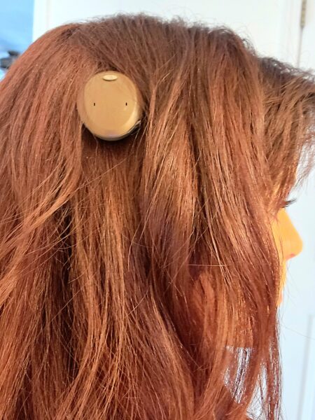 A side profile picture of Elly, a woman with conductive hearing loss and her brown Osia Sound Processor attached to her head. 