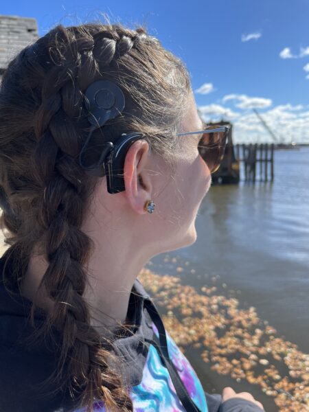 Cassandra, who self-paid for her cochlear implant, shown from behind so the sound processor is visible on her ear, looking out over a dock and body of water. 