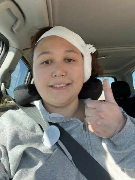 Taylor, smiling for a photo, showing a thumbs up, after she just completed her Osia System surgery, and is wearing a head wrap bandage. 