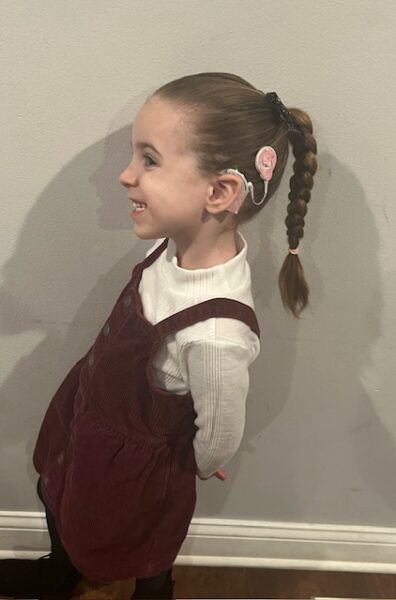 Abby, a young girl smiling as she poses for a side-profile photo. Her cochlear implant is visible on the back of her ear. 