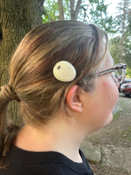 A side profile photo of Erika, who benefits from Cochlear bone conduction solutions, standing near a tree in a wooded area, with the Osia Sound Processor placed just above her ear.