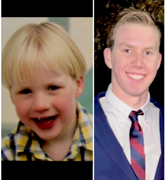 Two photos of Mickey, who was raised as a child with hearing loss, shown side-by-side - one as a child, and the other as an adult in a blue suit smiling.